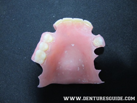 Unpolished treatment denture. - denturesguide.com